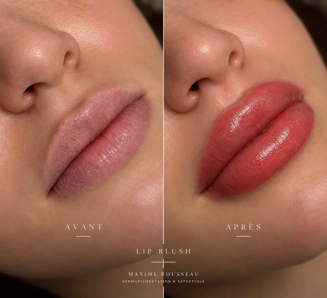 Avant et après un Lip Blush
