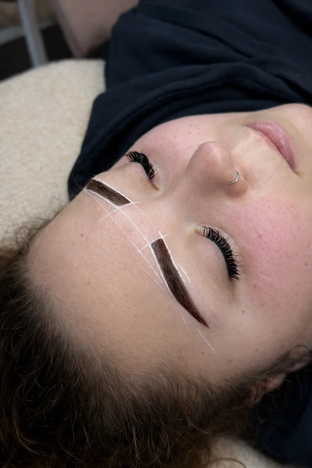Mapping préparatoire d’une reconstruction des sourcils